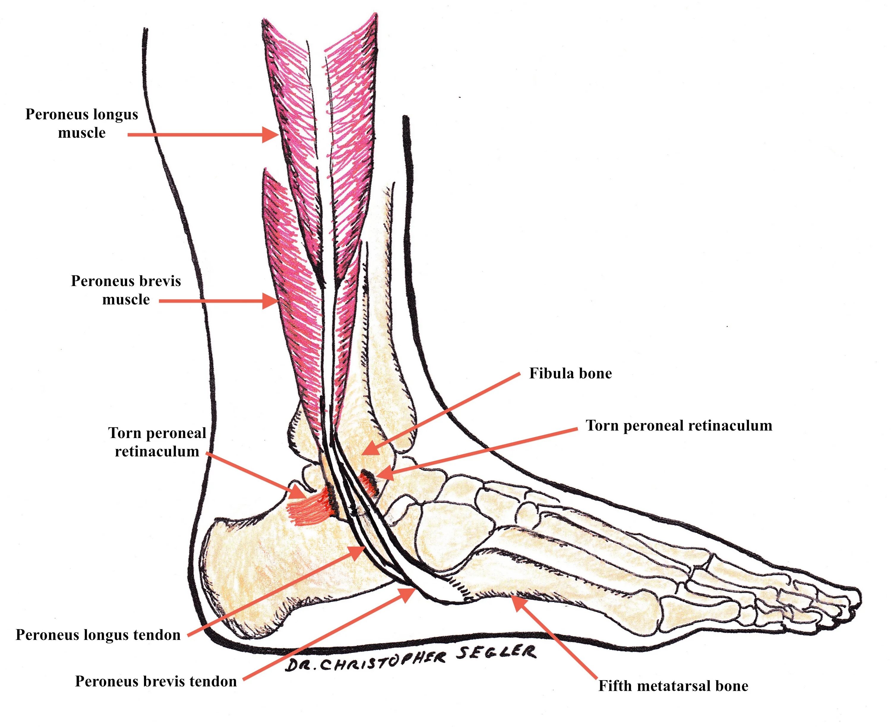 Где находится щиколотка на ноге фото. Peroneus Longus. Peroneus Longus and Brevis. Нерв голеностопного сустава анатомия. Анатомия голеностопного сустава нервы.