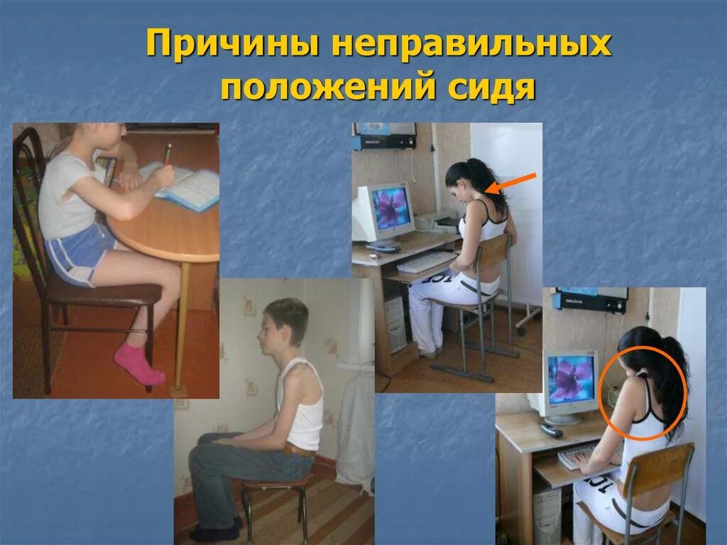 Почему неправильно. Неправильная посадка за партой искривление позвоночника. искривление позвоночника из за неправильной парты. искривление позвоночника из-за неправильной посадки за партой. заболевания при неправильной посадке обучающихся.
