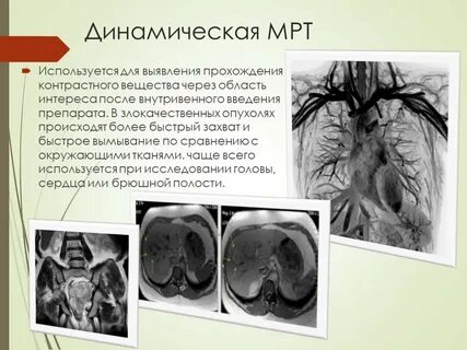 Вред от мрт