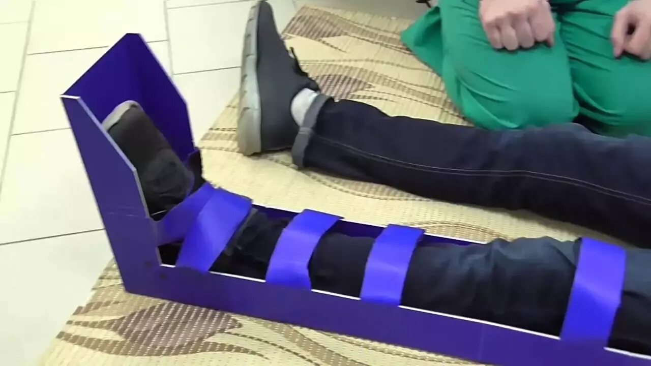 Помощь при переломе стопы