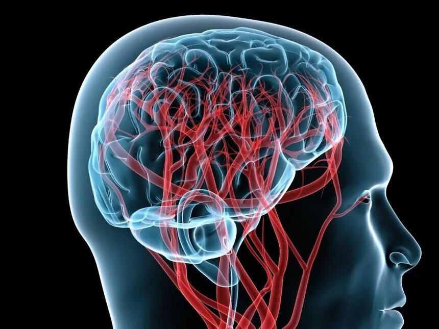 Цереброваскулярный инсульт. Кровообращение мозга. Кровоток головного мозга. Сосудистая система.