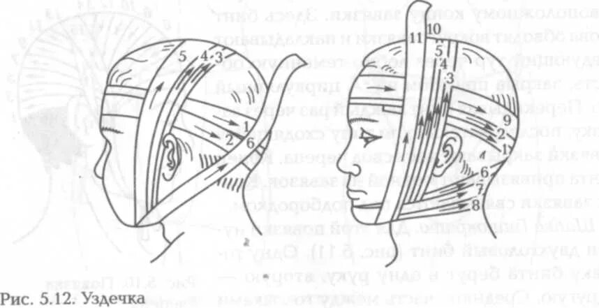 Повязка на голову десмургия уздечка. Перевязка уздечка головы алгоритм. Техника наложения повязки чепец. Уздечка бинтование. Повязка уздечка накладывается