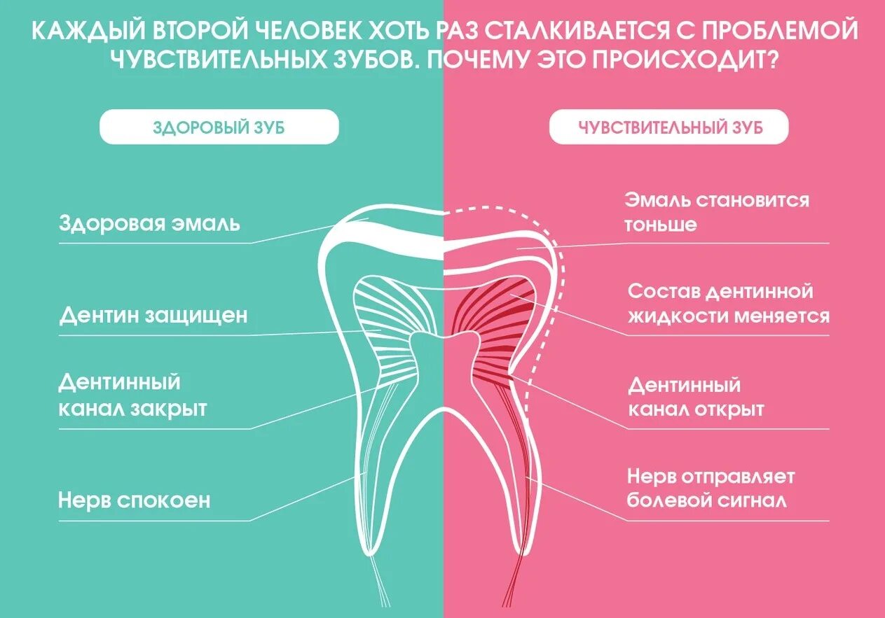 Почему сильно зуб. Повышенная чувствительность зубов. Чувствительность зубов причины. Причины повышенной чувствительности зубов. Чувствительные зубы причины.