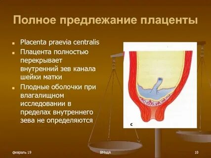 Внутренний и наружный зев матки