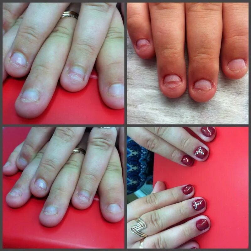 наращивание ногтей короткие. маникюр на короткие обгрызанные ногти. нарастить ногти на обгрызанные короткие ногти. нарощенные ногти до и после. наращивание на обгрызанные ногти.