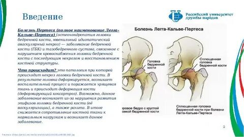 Психосоматика левого тазобедренного сустава