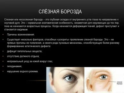 Борозда глаза