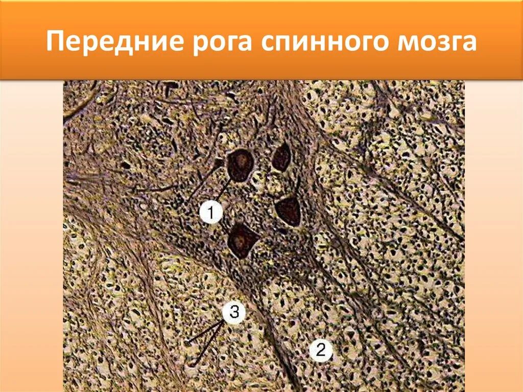 Спинной мозг гистология препарат. Поперечный срез спинного мозга импрегнация серебром. Поперечный срез спинного мозга гистология. Спинной мозг гистология импрегнация серебром.