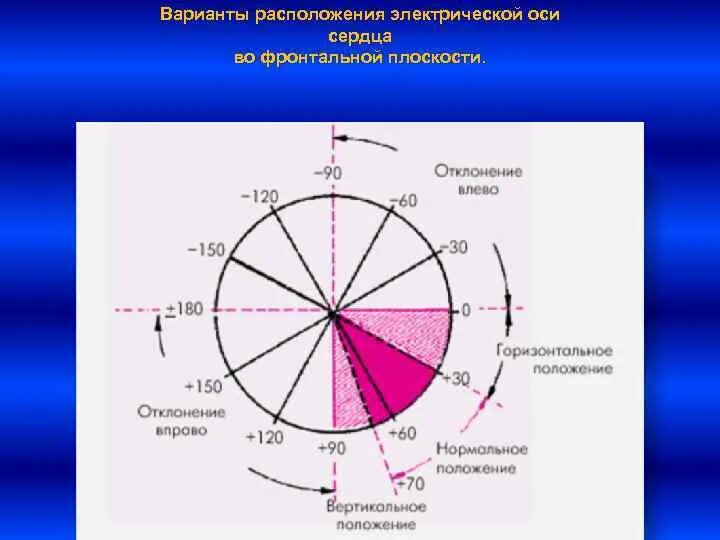Смещение эос влево
