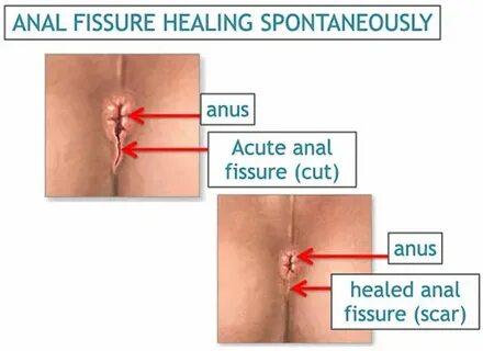 Dengizdagi fohisha surati