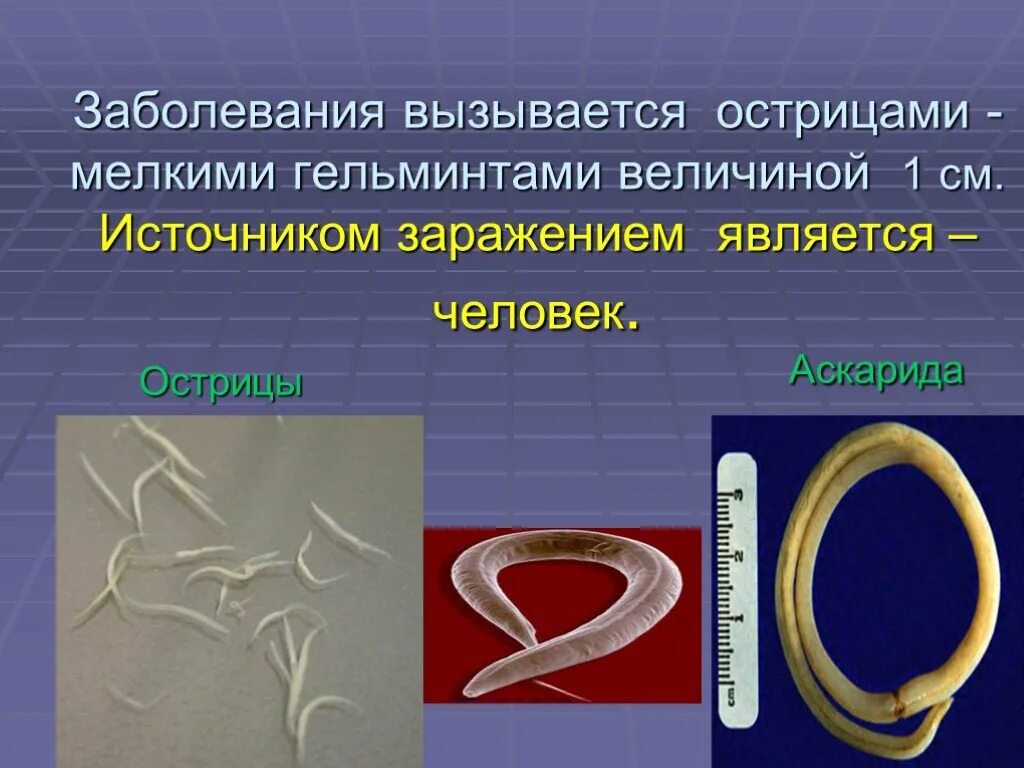 Какой вред могут причинить взрослые аскариды человеку. Методы профилактики аскариды человеческой. Гельминтозы заболевания.