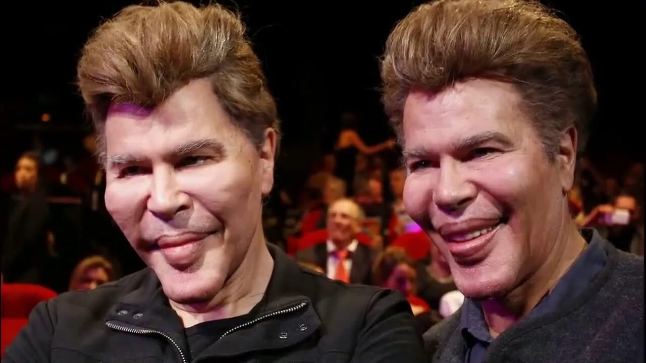 Близнецы с пластическими операциями