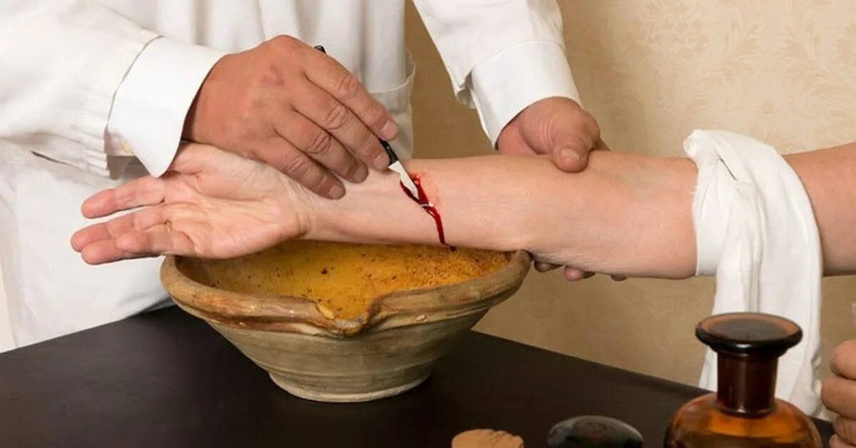 Лечение кровью человек. Кровь медицина. Судебно-химического исследования крови. Непрямое переливание крови. Безаппаратный мембранный плазмаферез.