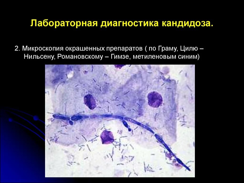 Микроскопия окрашенных. Микроскопия мазка кандидоза. мазок кандида микроскопия. кандидоз,микроскопия, окраска.