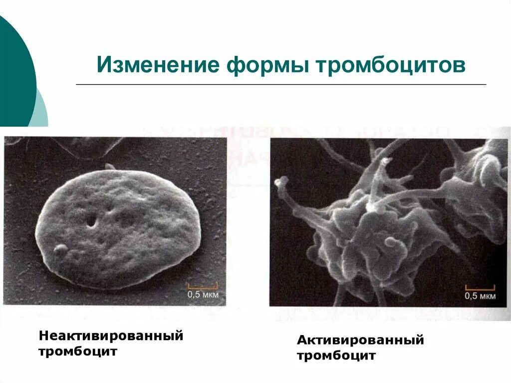 Строение тромбоцитов человека. Тромбоциты форма и строение. активированные тромбоциты. строение тромбоцитов. активация тромбоцитов.