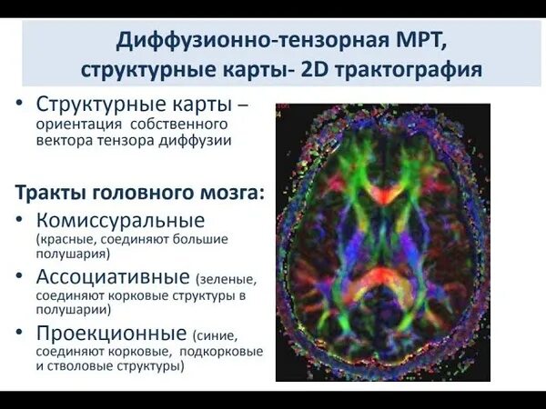 Диффузное мрт. Диффузионно-тензорная мрт. мрт трактография головного мозга. диффузионная спектральная томография. дитфузно тензорная мрт.