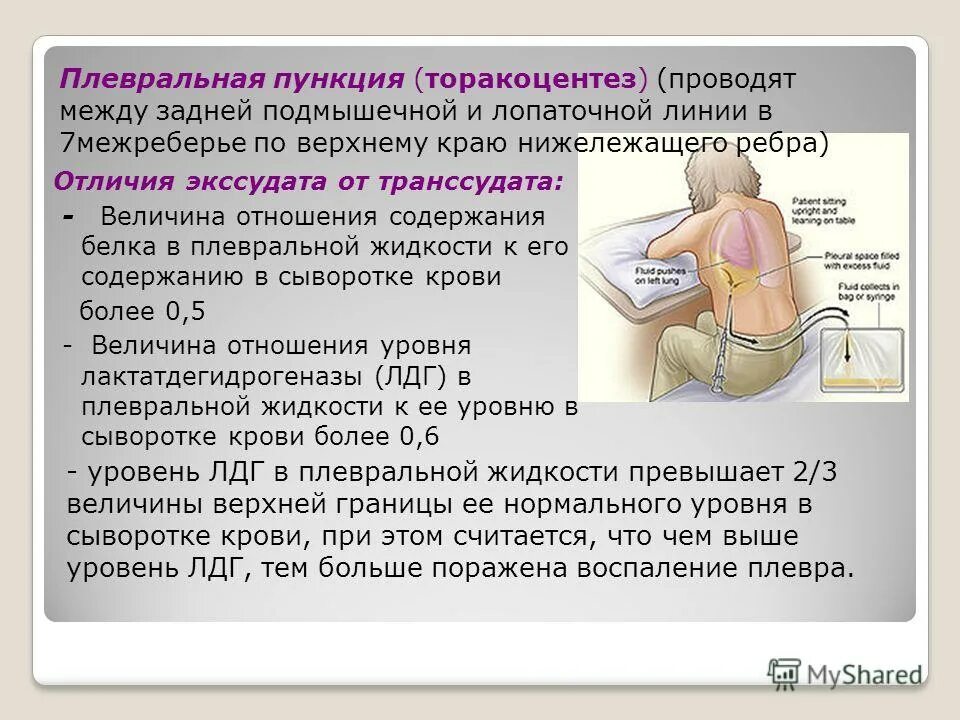 Состояние после пункции