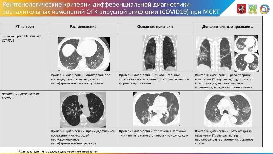 Можно по кт определить. Разрешение ковид пневмонии на кт. Кт легких пневмония коронавирус диагноз. Кт диагностика поражения легких при Covid-19.. Степень поражения легких при коронавирусе на кт.