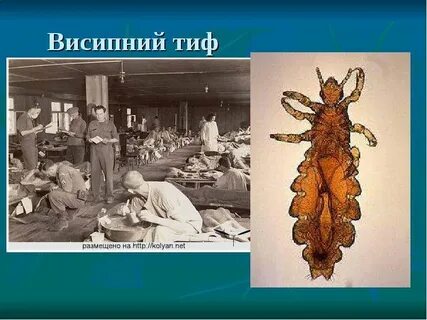 Виды сыпного тифа