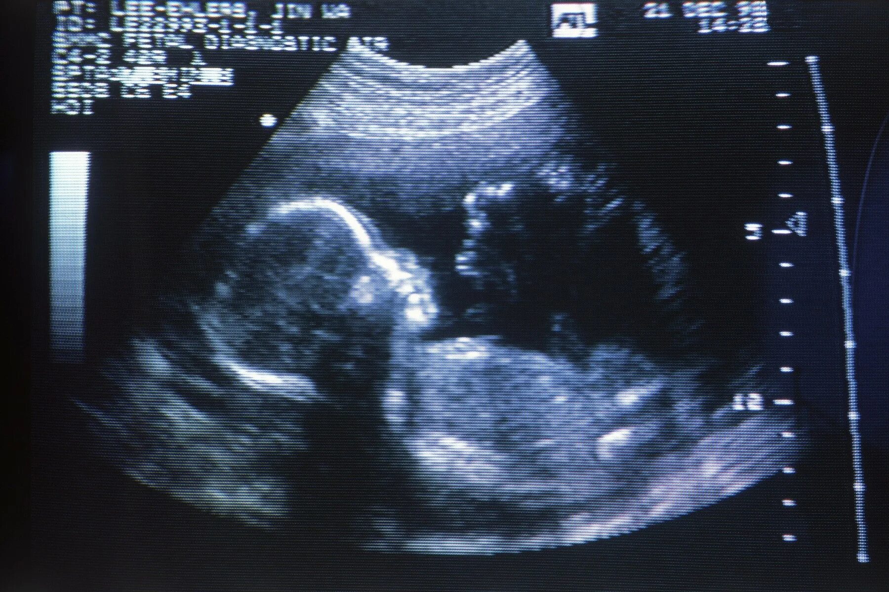 УЗИ плода скрининг 1 триместр. III триместр беременности УЗИ. УЗИ беременности 3 скрининг. УЗИ скрининг в 20 недель беременности. Будет в 44 неделе