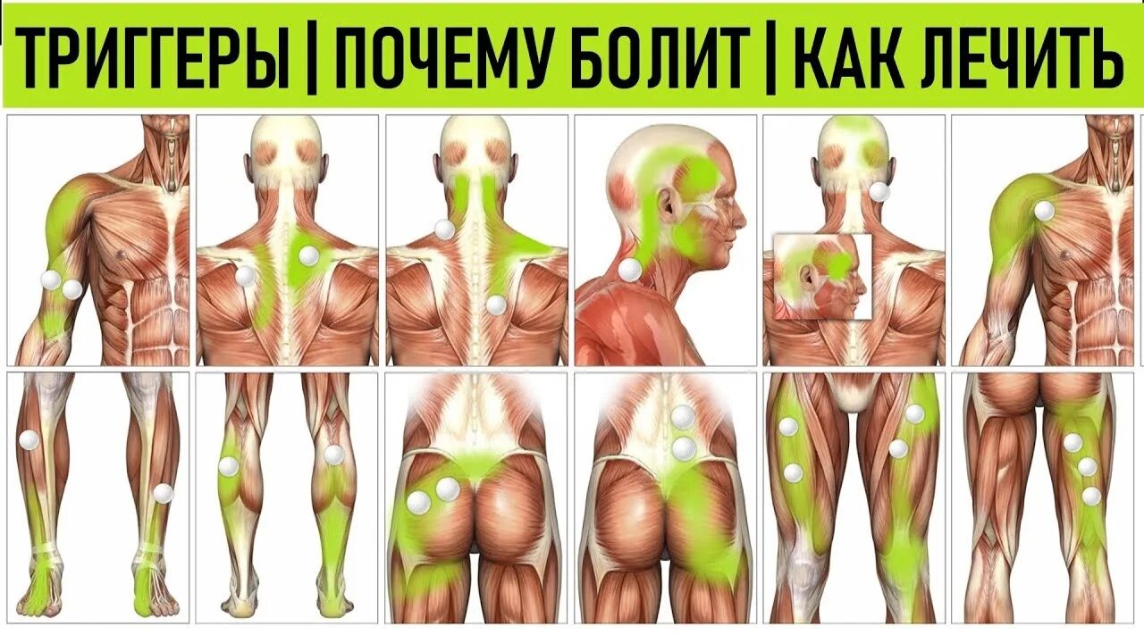 Атлас триггерных точек. Клинический атлас триггерных точек эндрю бил. Атлас триггерных точек. Атлас триггерных точек. Миофасциальный синдром триггеры.