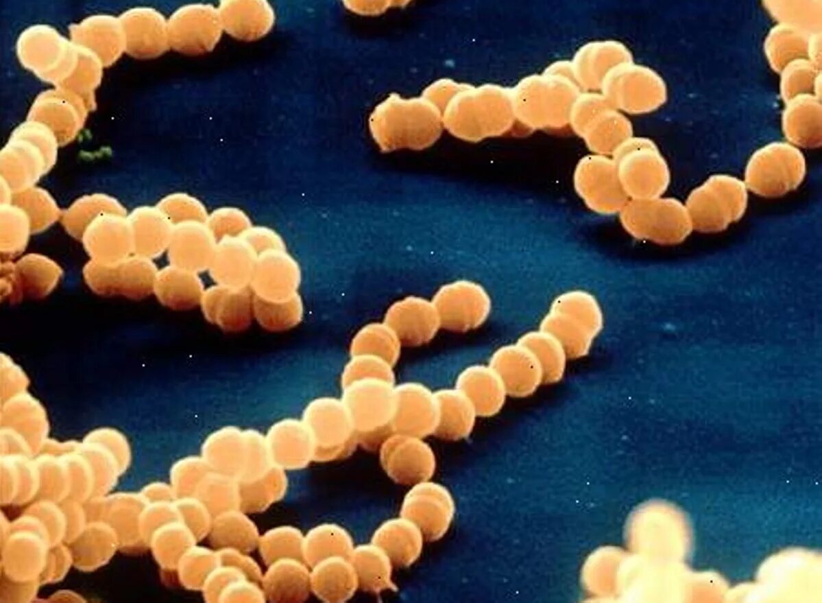 Гемолитический стрептококк streptococcus haemolyticus. Бета гемолитический стрептококк группы а. Бета-гемолитическими стрептококками групп b. Бета гемолитический стрептококк группы а. Β-гемолитический стрептококк группы а.