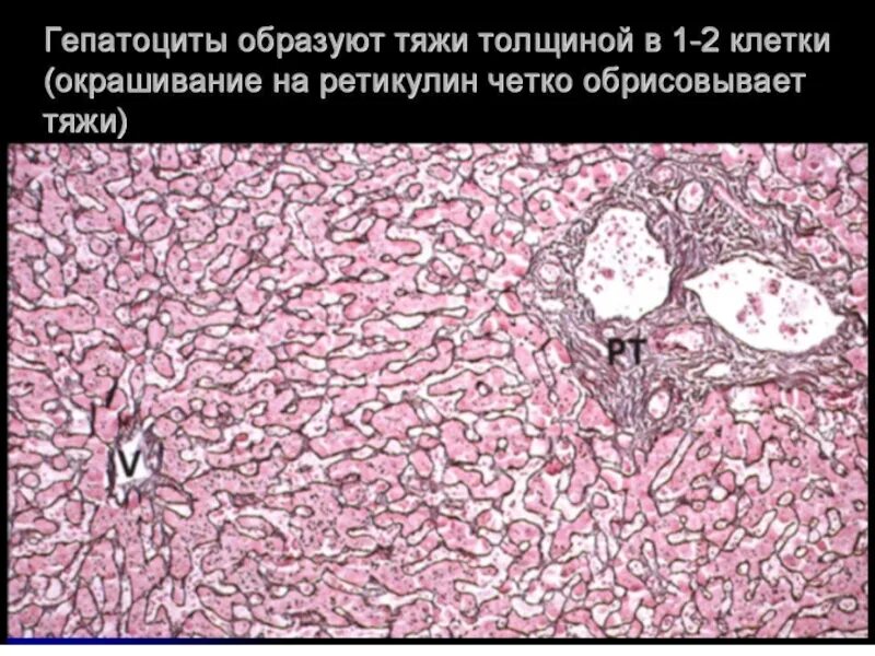 Гепатоциты человека. Поврежденные гепатоциты. регенерация гепатоцитов.
