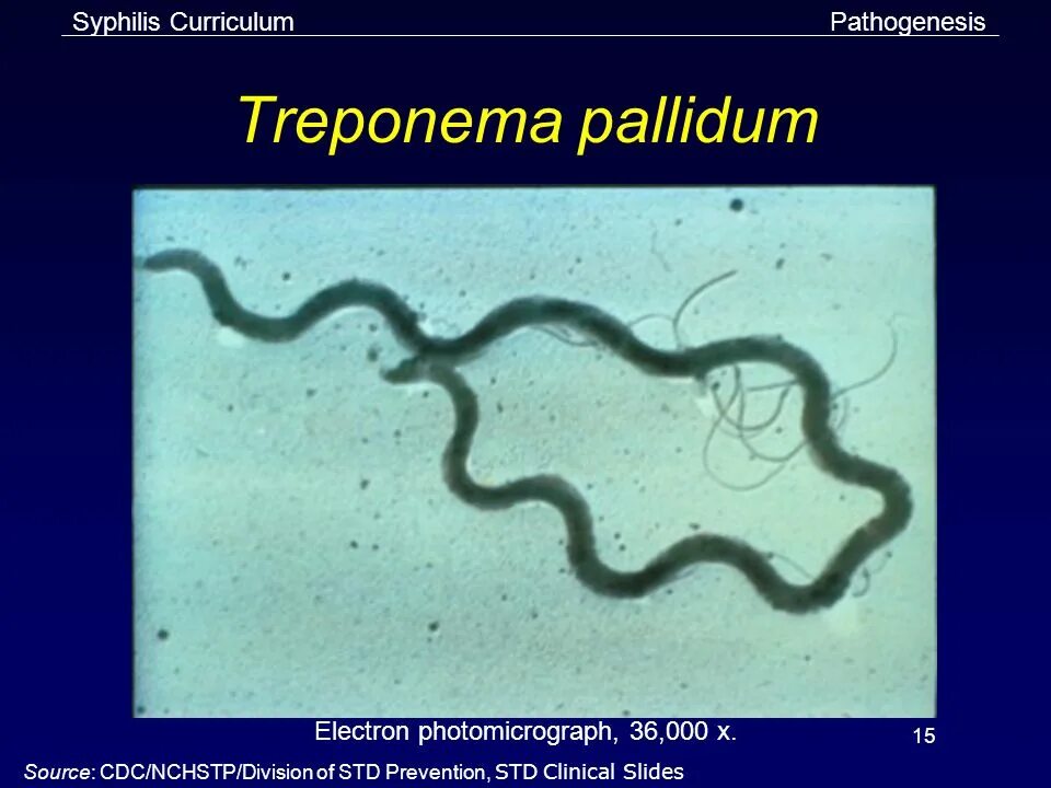 Бледная трепонема treponema pallidum. Сифилис трепонема паллидум. Спирилла бледная трепонема.