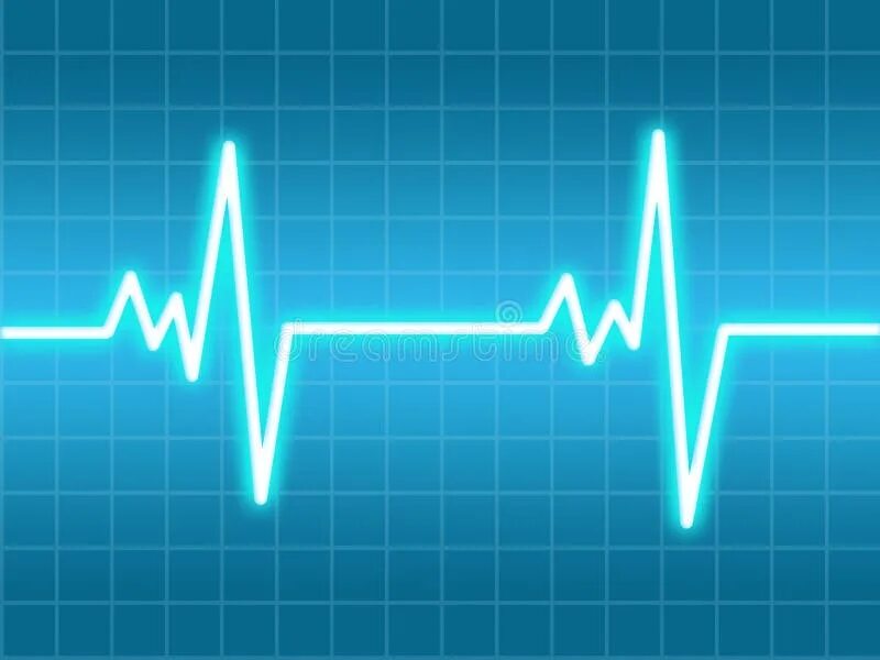 Пульс норма у женщин. Опасные фото. Нфр удар. Месси 91. Пульс 90 ударов в минуту норма.