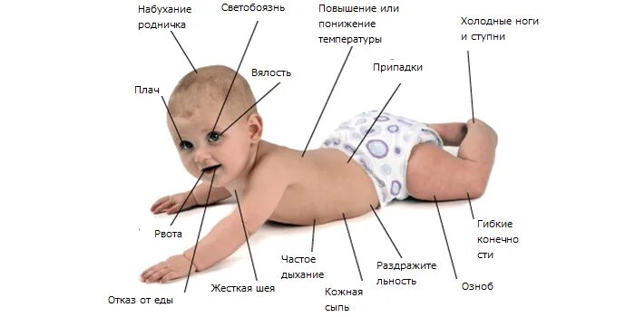 Голова горячая а температуры нет у ребенка