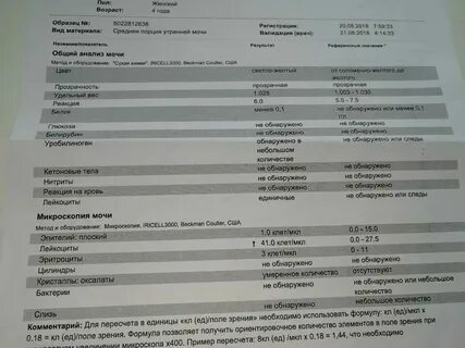 Лейкоцитов 25 в анализе мочи