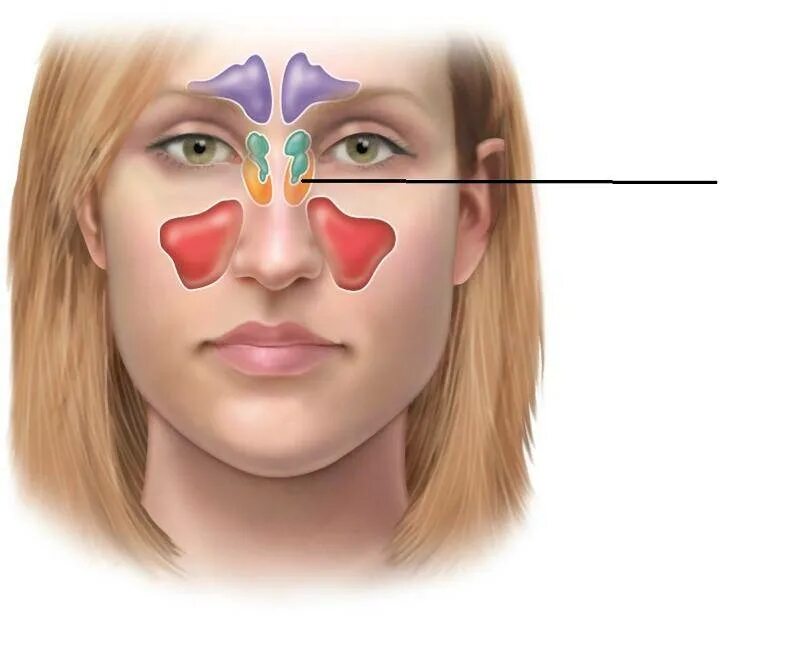 Гайморова пазуха. Синусит фронтит этмоидит сфеноидит. Гайморовы пазухи гайморит. Синусит верхнечелюстной пазухи. Синус верхнечелюстной пазухи.