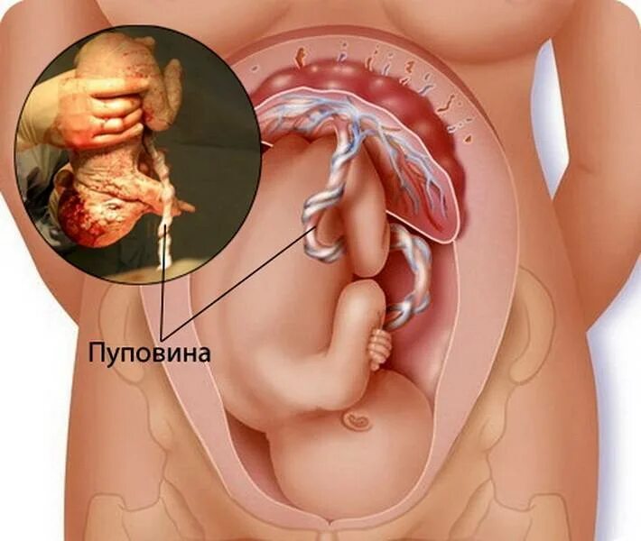 Где находится роды. Ребенок с пуповиной в животе. Плацента с пуповиной после родов.