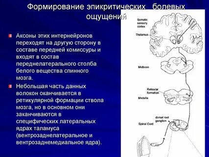Эпикритическая боль