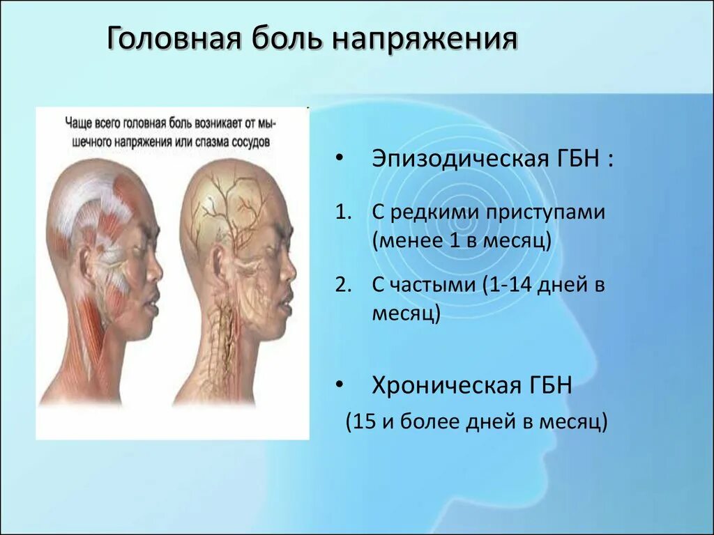 Головная боль напряжения это. Головная боль. От нервов болит голова. Головная боль от напряжения. Типы головной боли.