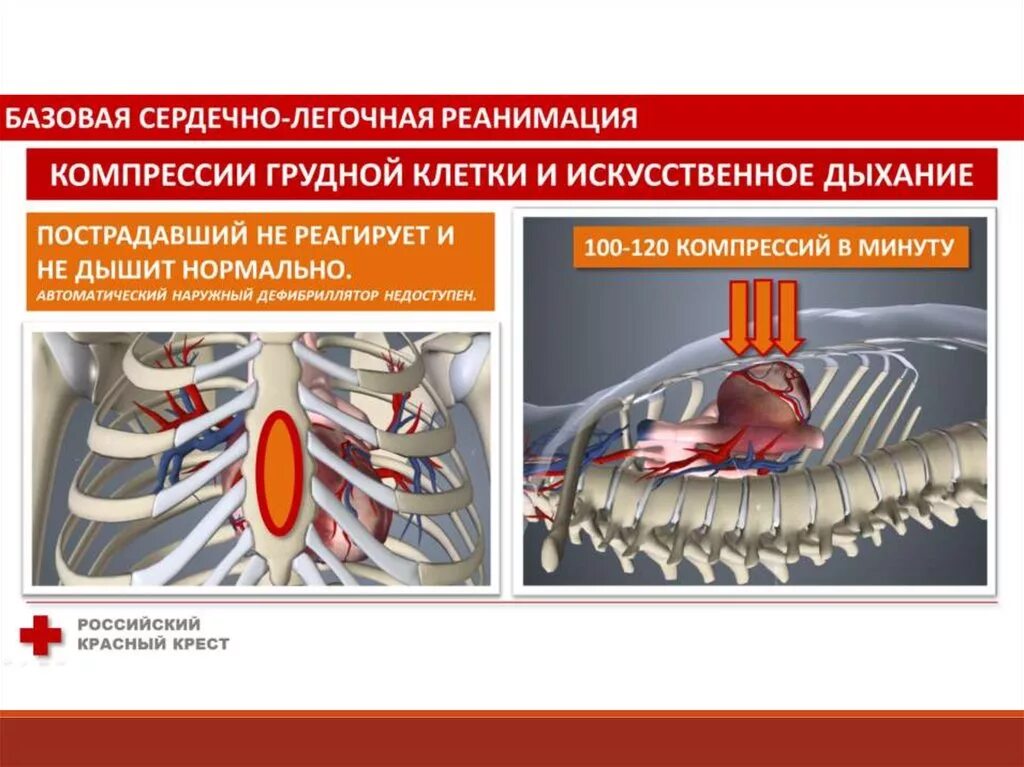 СЛР компрессии грудной клетки. Компрессия грудной клетки при сердечно легочной реанимации. Базовая сердечно-легочная реанимация. . Базовая сердечно – легочная реанимация (СЛР).. Сжатие груди