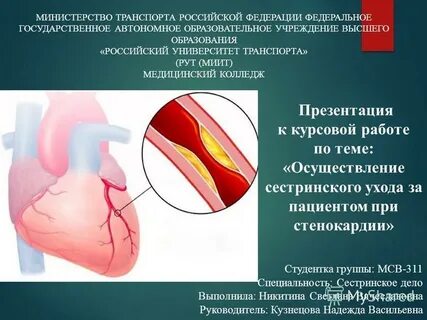 Инфаркт миокарда дипломная работа