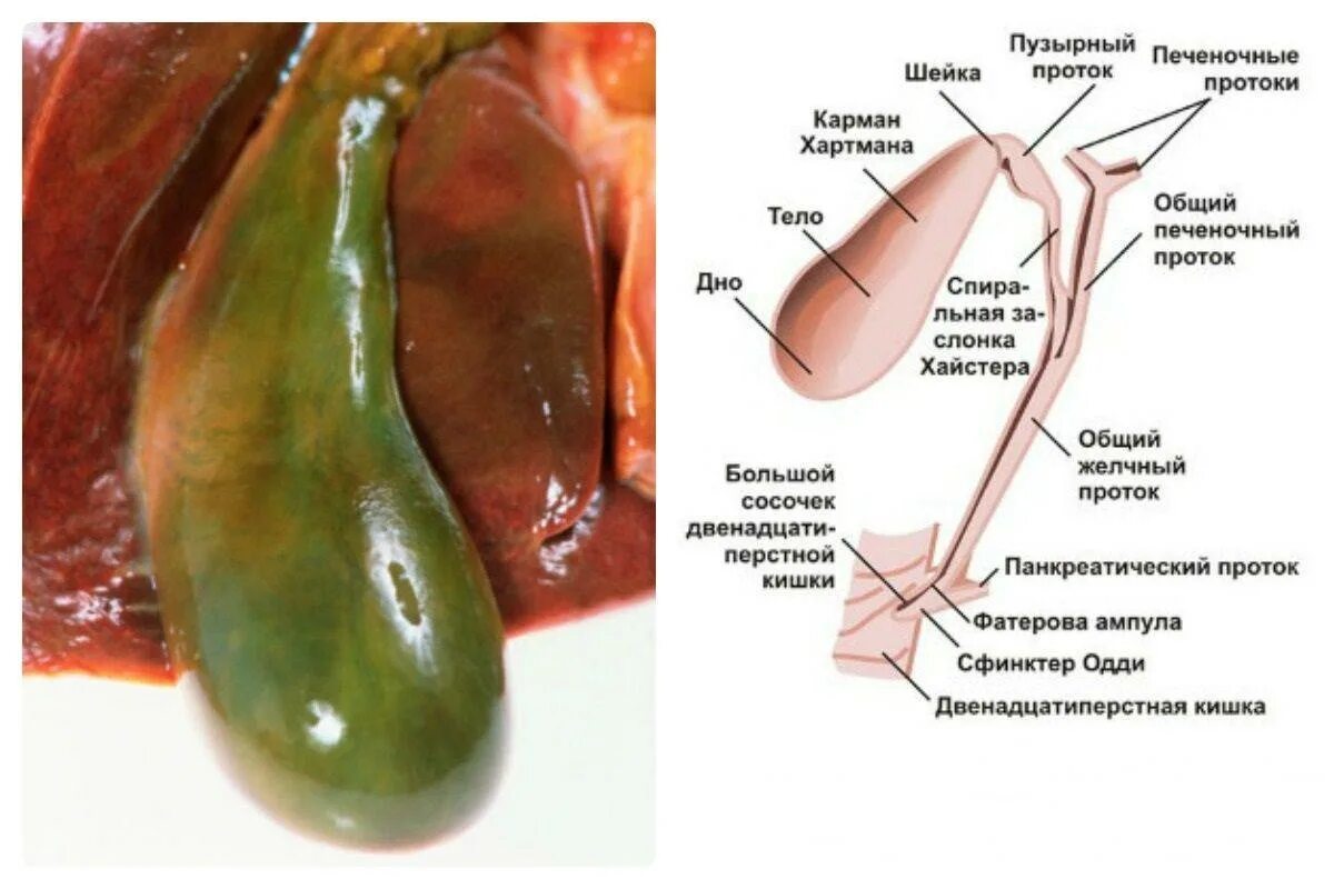 Почему выходит желчь. Пузырный проток печени. Желчный пузырь препарат анатомия. Желчный пузырь сфинктер Одди анатомия.