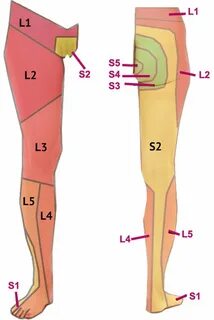 Радикулопатия l5