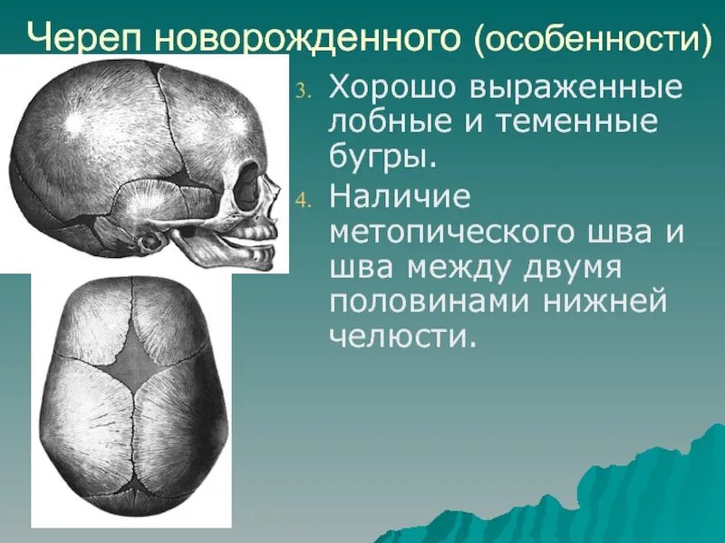 Выраженные лобные бугры