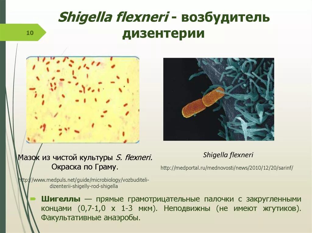 Шигеллы вызывают заболевание. Шигеллы факультативные анаэробы. Shigella dysenteriae анаэроб. Морфология шигелл микробиология. Морфология возбудителя дизентерии.