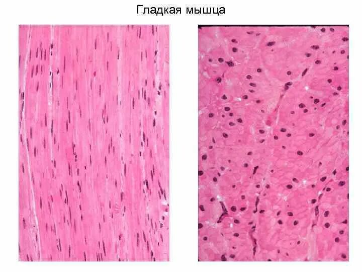 Гладкая мышечная ткань гистология. Гладкомышечная ткань гистология. Гладкая мышечная ткань гистология препарат. Гладкая мускулатура гистология. Гладкая мышечная ткань в дерме