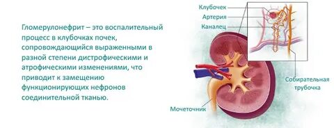 Глоумонефрит почек