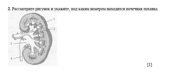 Почечная лоханка рисунок. Ворота почки располагаются. Типы строения лоханки. Почечная лоханка на Латын.