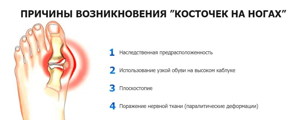 Почему болит кость пальца. Болит кость стопы сбоку возле большого пальца. Косточка на стопе у большого пальца болит. Кость сбоку на большом пальце. Торчит кость сбоку ступни.