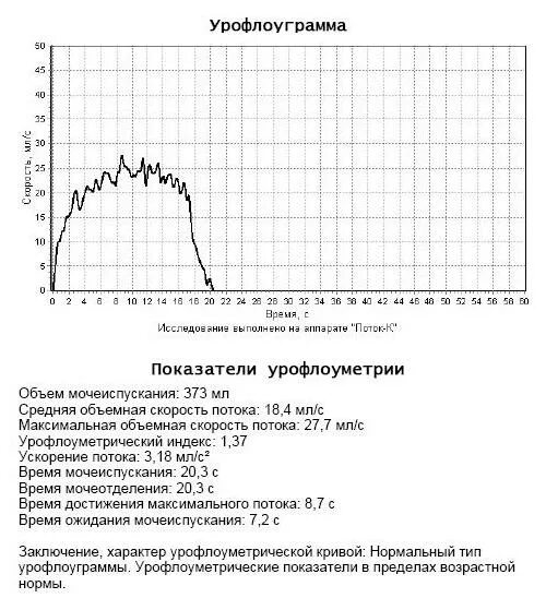 Урофлоуметрия расшифровка графиков. Урофлоуметрия расшифровка показателей. Урофлоуметрия нормальная кривая. Нормальные показатели урофлоуметрии.