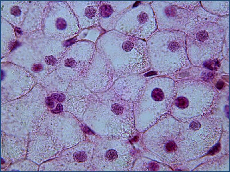 Общая морфология клетки печени аксолотля. Цитология гистология клетка. Клетка печени аксолотля. Окраска: гематоксилин-эозин. Общая морфология клетки цитология.