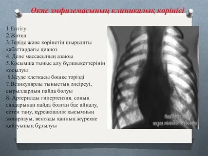 Мини трусикидегі лесбиянки