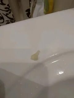 Цвет пробки отходящей у беременных