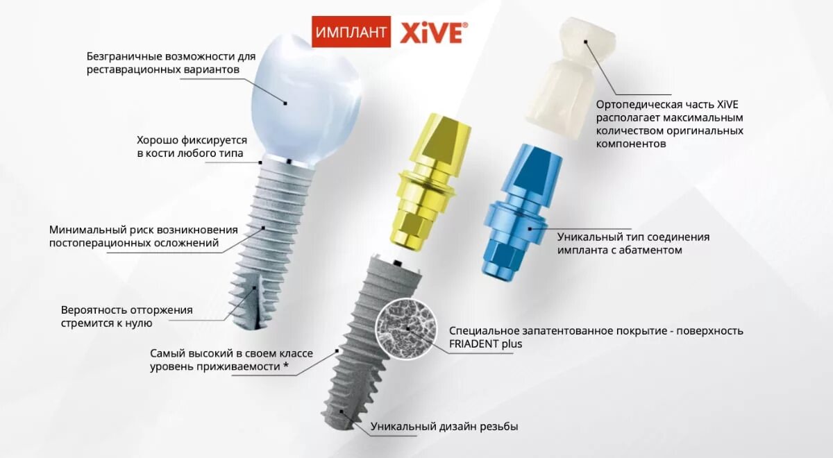 Какие размеры импланты. Имплант системы xive. импланты системы xive ankylos. xive импланты производитель. xive имплант с зубом.